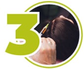 Injektion des Blutplasmas in die Kopfhaut bei einer PRP Behandlung