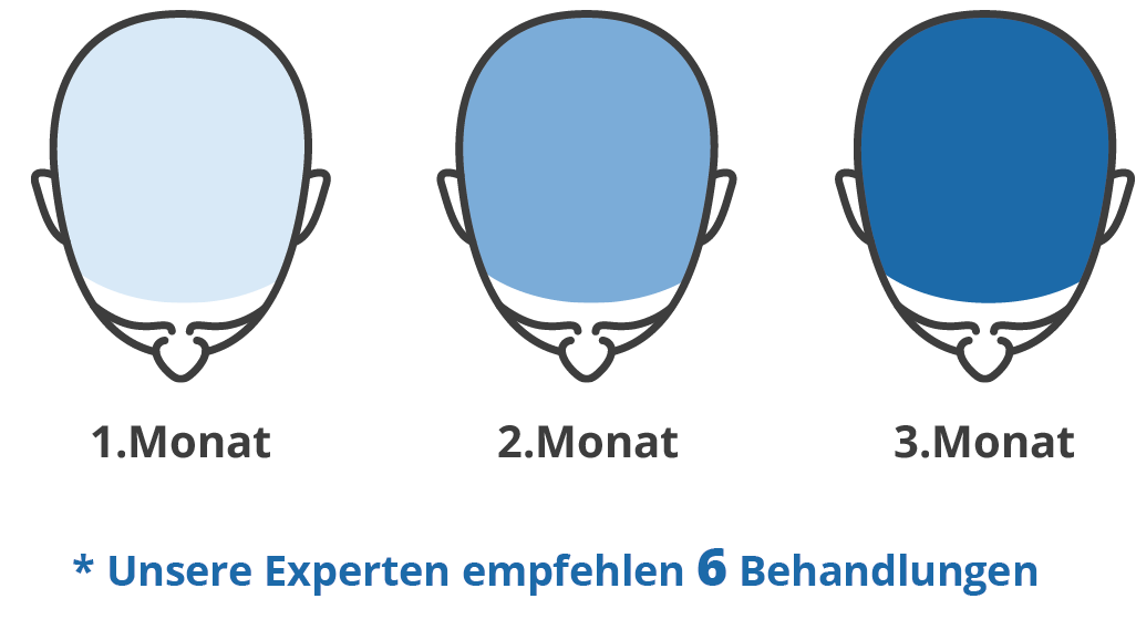 Infografik zu den Ergebnissen anhand der PRP Studie