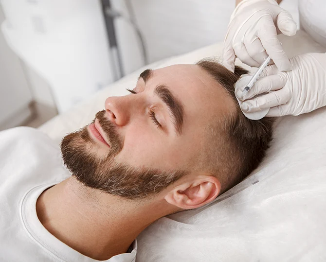 Patient während einer PRP Behandlung – Injektion des aufbereiteten Eigenbluts zur Stärkung der Haare und Förderung des Wachstums