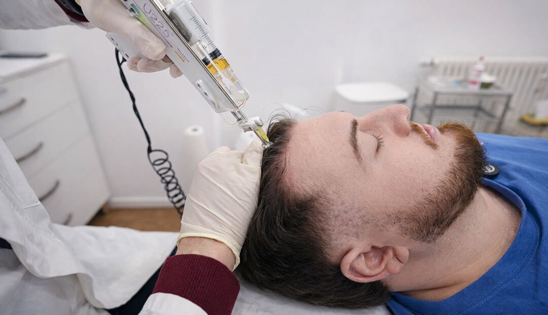 PRP Behandlung mit der U225 Pistole am Patienten